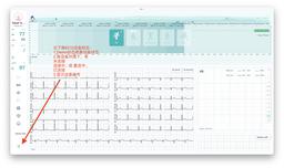 ECG设备图示
